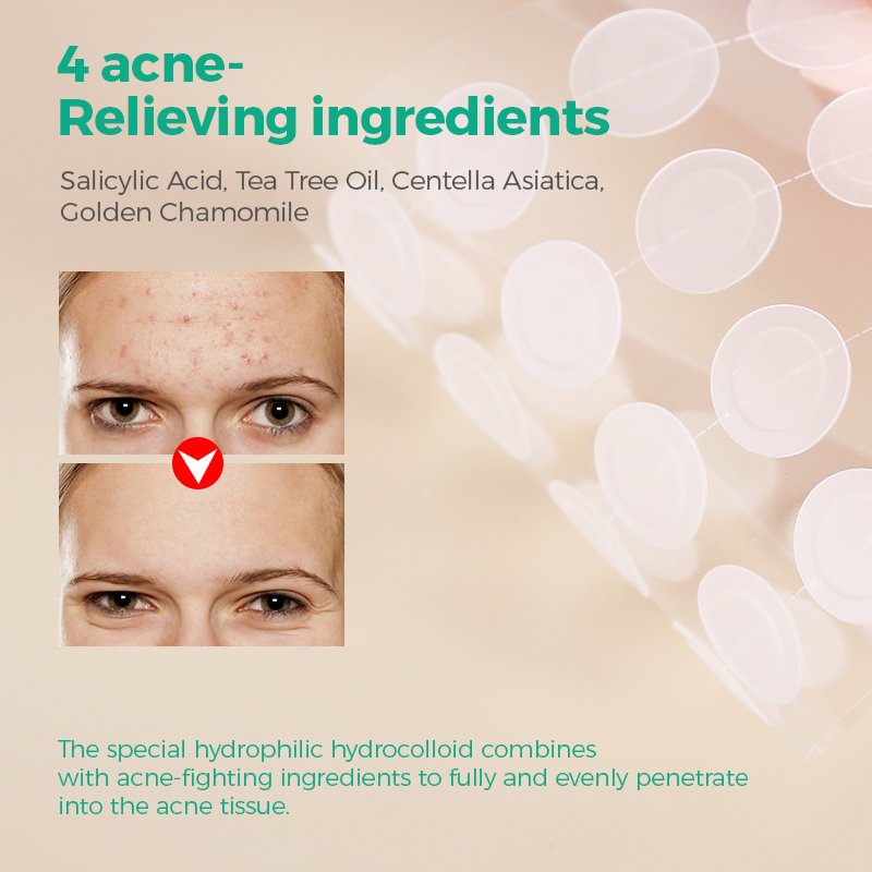 Colorful Star Vitamin B5 Aloe Acne Removing Patch - 10